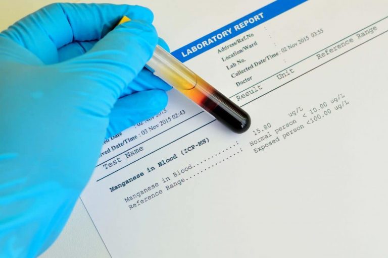 The Importance of Treating Manganese in Drinking Water Tata & Howard